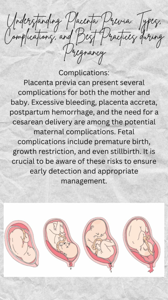 Placenta Previa